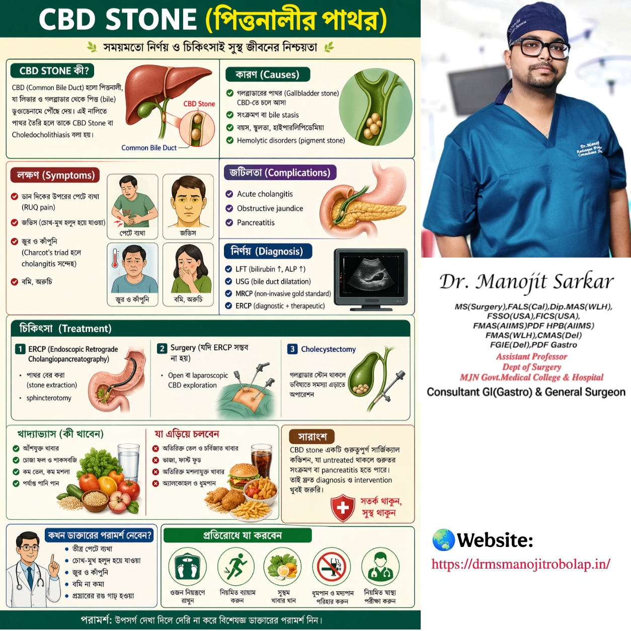 CBD Stone(পিত্তনালীতে পাথর)
